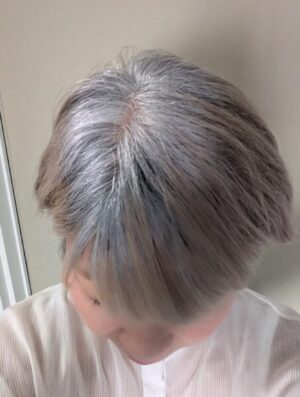伸びてきた頭頂部の白髪